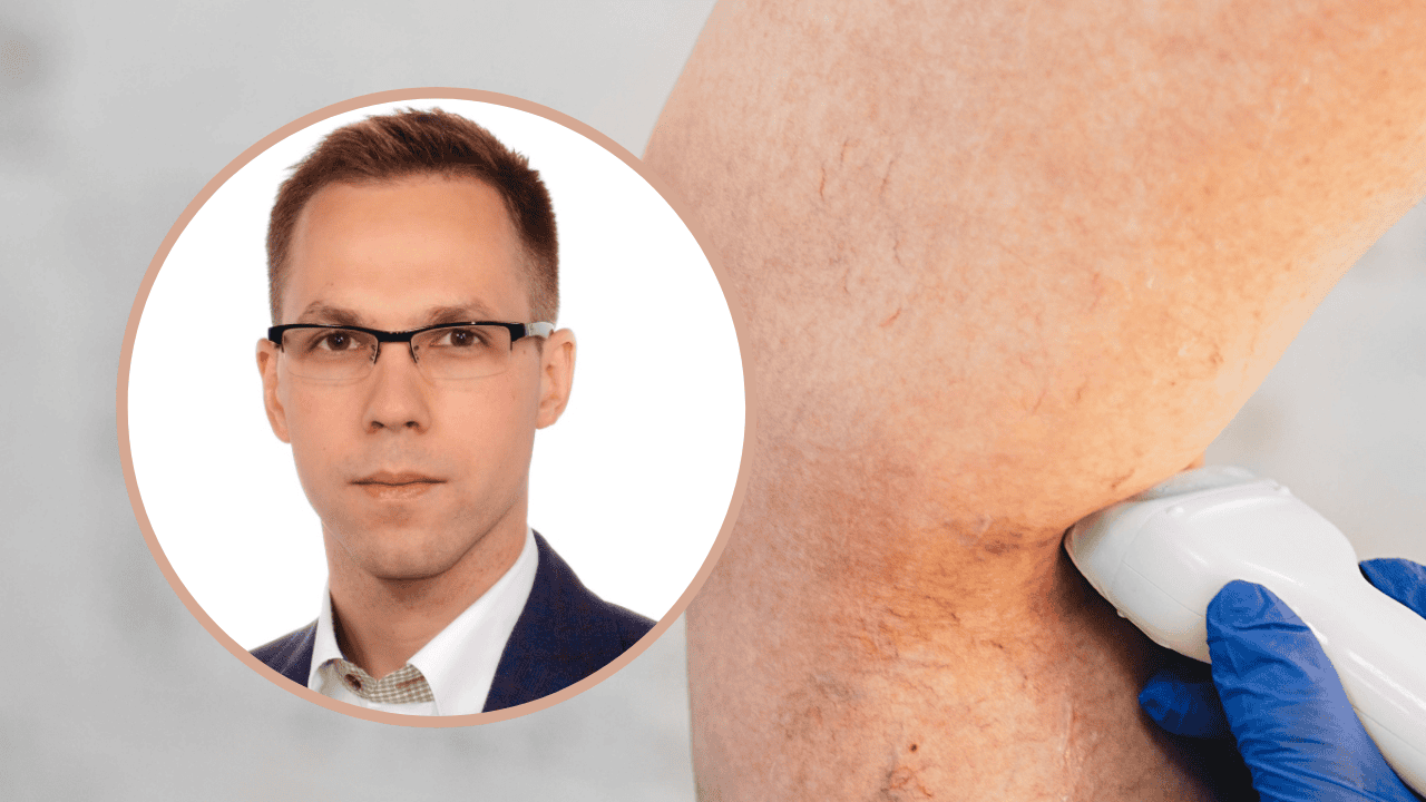 Tak wygląda miażdżyca nóg. Lekarz mówi, na co zwrócić uwagę