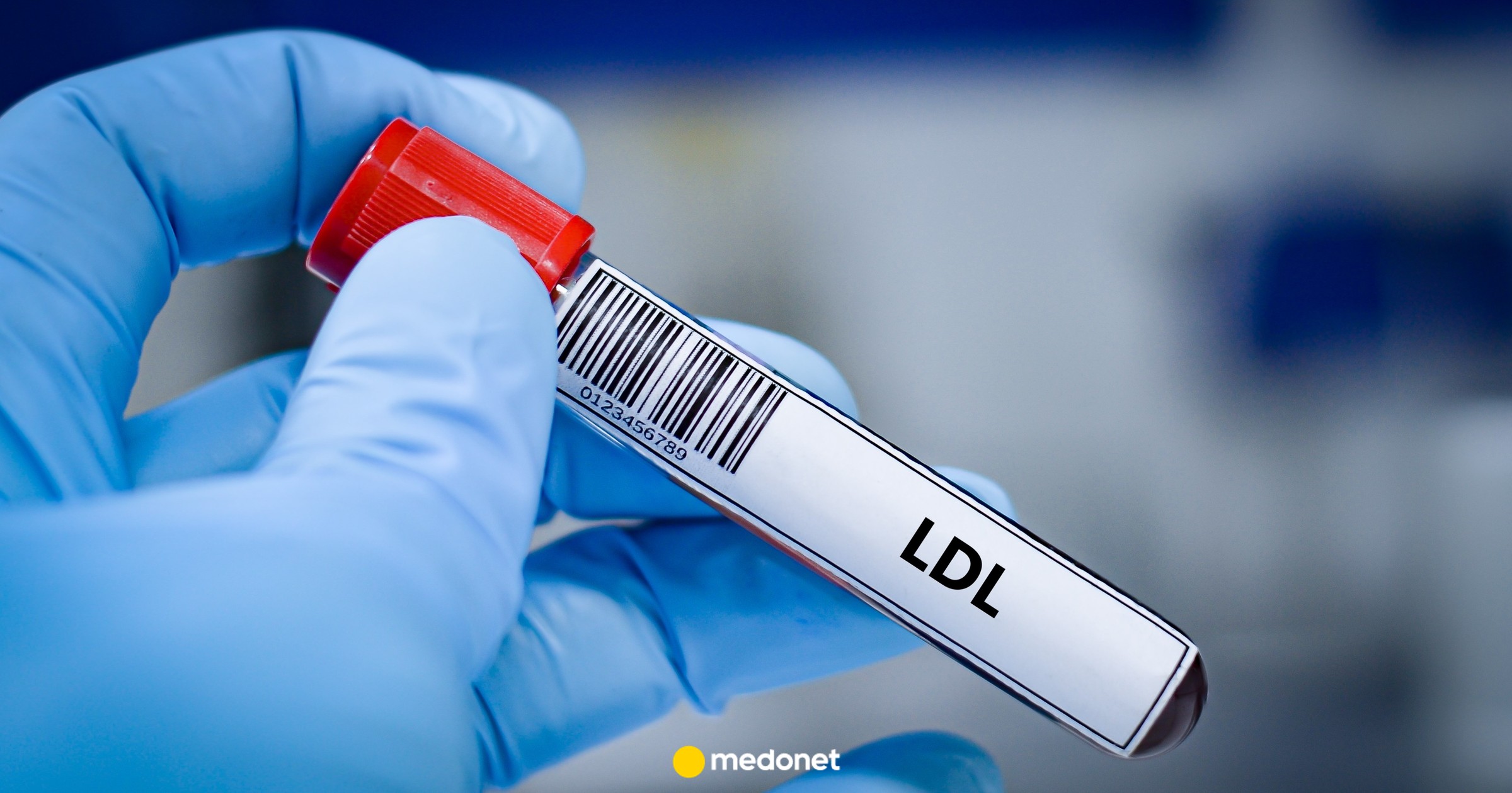 „Dieta ma tylko niewielki wpływ na poziom cholesterolu”. Lekarze grzmią: to nie choroba, to czynnik ryzyka