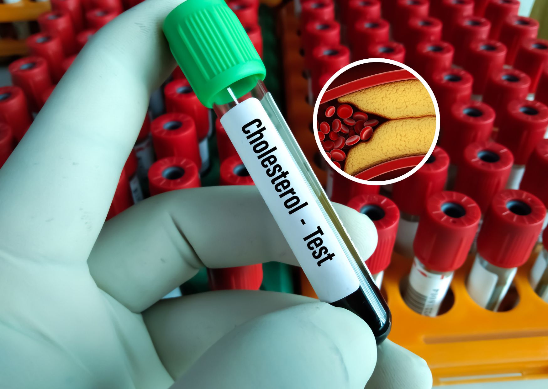 Wypłukuje cholesterol z tętnic. „Ostatnia deska ratunku”